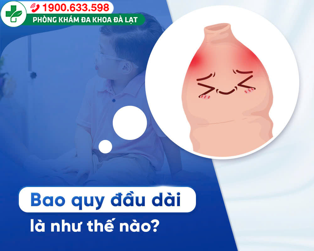 BAO QUY ĐẦU DÀI LÀ NHƯ THẾ NÀO?